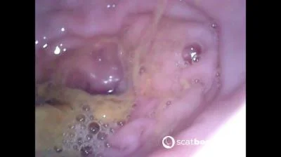 Show Inside Of My Ass With Endoscope (Sweet Tinqerbell) [FullHD 1080p] 378 MB stuhlgang-hd