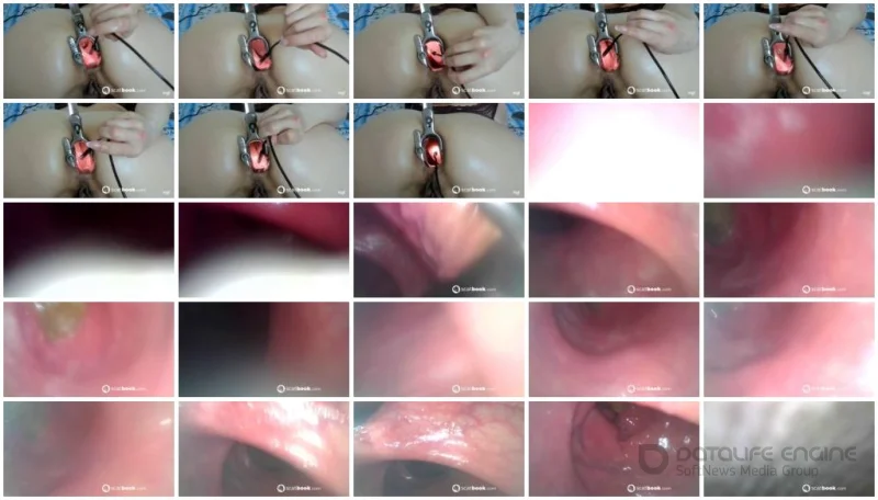 Watch Gape With Speculum (Sweet Tinqerbell) [FullHD 1080p] 118 MB Online