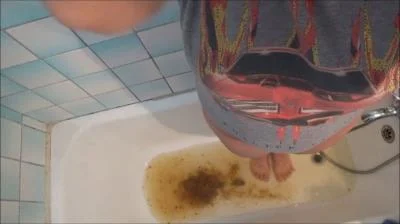 Watch Shitting Urge And Enema [SD] 377 MB Online