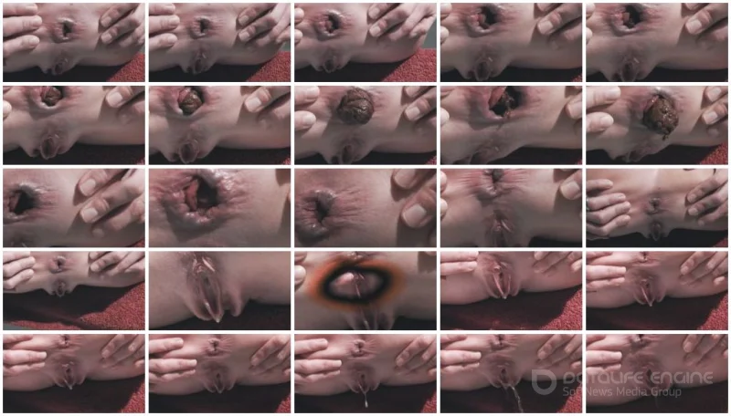 Watch Close Shit With Prolapse (Mia Skye aka MiaRoxxx) [HD 720p] 17.1 MB Online